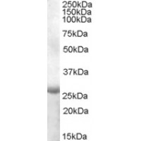 Western Blot (1μg/ml) staining of Human Muscle lysate (35μg protein in RIPA buffer). Primary incubation was 1 hour. Detected by chemiluminescence.