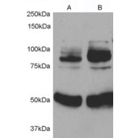 Western Blot (0.5μg/ml) staining of 1) Rat Aortic Smooth Muscle cell lysate 2) after infection with Human APPL1 adenovirus for 48hrs. Detected by chemiluminescence. Data kindly provided by Dr. L. Jia, Ann Arbor, USA.