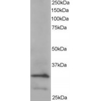 Western Blot staining (0.2μg/ml) of Hela lysate (RIPA buffer, 35μg total protein per lane). Primary incubated for 1 hour. Detected by western blot using chemiluminescence.