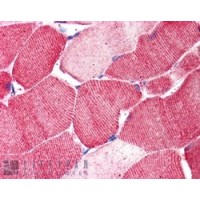 Immunohistochemistry (5μg/ml) staining of paraffin embedded Human Skeletal Muscle. Steamed antigen retrieval with citrate buffer pH 6, AP-staining.