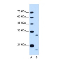 Western blot analysis of CCPG1 in HepG2 Cell Lystate using CCPG1 antibody at 0.25 μg/mL (12% gel). Marker in lane A.