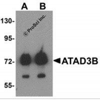Western blot analysis of ATAD3B in human kidney tissue lysate with ATAD3B antibody at (A) 1 and (B) 2 μg/mL .