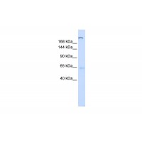 Antibody used in WB on Human Liver at 0.2-1 ug/ml.