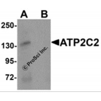 Western blot analysis of ATP2C2 in 3T3 cell lysate with ATP2C2 antibody at 1 μg/mL in (A) the absence and (B) the presence of blocking peptide.