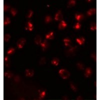 Immunofluorescence of ATP2C2 in 3T3 cells with ATP2C2 antibody at 20 μg/mL.