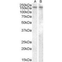 Western Blot (0.5μg/ml) staining of Human Amygdala lysate (35μg protein in RIPA buffer) in lane A and Western Blot (0.05μg/ml) staining of Rat Brain lysate (35μg protein in RIPA buffer) in lane B . Primary incubation was 1 hour. Detected by chemiluminescence.
