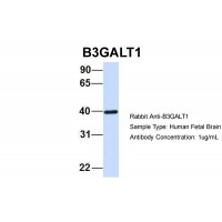 Antibody used in WB on Hum. Fetal Brain at 1 ug/ml.