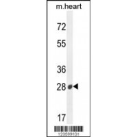 Western blot analysis in mouse heart tissue lysates (35ug/lane).