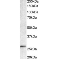 Western Blot staining (1μg/ml) of Human Lymphnode lysate (RIPA buffer, 35μg total protein per lane). Primary incubated for 1 hour. Detected by western blot using chemiluminescence.