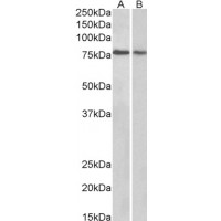 Western blot (0.3 μg/ml) staining of Human Cerebellum (A) and Rat (B) Brain lysate (35 μg protein in RIPA buffer). Primary incubation was 1 hour. Detected by chemiluminescence