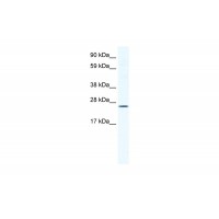 Antibody used in WB on Mouse NIH-3T3 at 1.25 ug/ml.