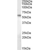 Western Blot (1μg/ml) staining of Human Heart lysate (35μg protein in RIPA buffer). Primary incubation was 1 hour. Detected by chemiluminescence.