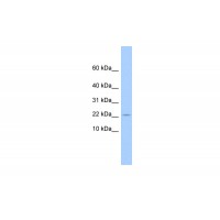 Antibody used in WB on Human 721_B at 0.2-1 ug/ml.