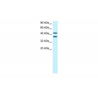 Antibody used in WB on Human HepG2 at 0.3-0.5 ug/ml.