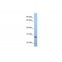 Antibody used in WB on Human Muscle at 0.2-1 ug/ml.