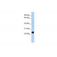 Antibody used in WB on Human HepG2 at 0.2-1 ug/ml.