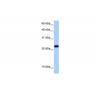 Antibody used in WB on Human Placenta at 0.2-1 ug/ml.