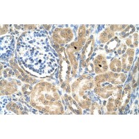 Antibody used in IHC on Human kidney.