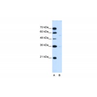 Antibody used in WB on Human HepG2 at 0.2-1 ug/ml.