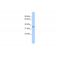 Antibody used in WB on Human Liver at 0.2-1 ug/ml.