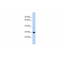 Antibody used in WB on Human Brain at 0.2-1 ug/ml.