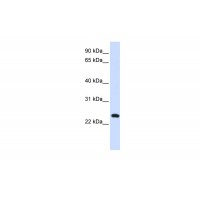 Antibody used in WB on Human 721_B at 0.2-1 ug/ml.