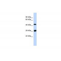 Antibody used in WB on Human Muscle at 0.2-1 ug/ml.