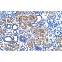 Antibody used in IHC on Human kidney.