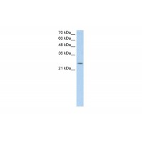 Antibody used in WB on Human HepG2 at 0.2-1 ug/ml.