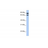 Antibody used in WB on Human 721_B at 0.2-1 ug/ml.