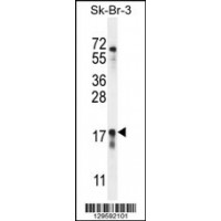 Western blot analysis in SK-BR-3 cell line lysates (35ug/lane).