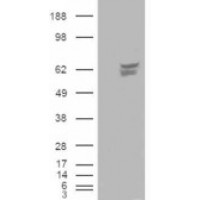 HEK293 overexpressing CACNB4 and probed with antibody (mock transfection in first lane).