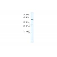 Antibody used in WB on Human Thymus at 2.5 ug/ml.