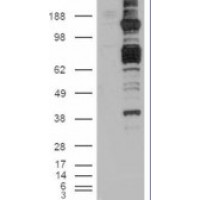 HEK293 overexpressing CARD11 and probed with antibody (mock transfection in first lane).