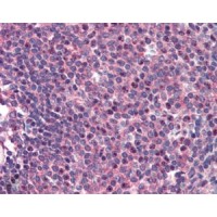 Immunohistochemistry (2μg/ml) staining of paraffin embedded Human Spleen. Steamed antigen retrieval with citrate buffer pH 6, AP-staining.