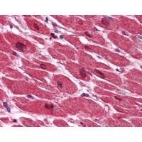 Immunohistochemistry staining of CARP in heart tissue using CARP Antibody.