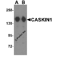 Western blot analysis of CASKIN1 in HeLa cell lysate with CLAUDIN4 antibody at (A) 0.25 and (B) 0.5 μg/mL.