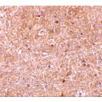 Immunohistochemistry of caspase-13 in mouse brain tissue with caspase-13 antibody at 10 μg/mL.