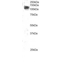 Western Blot staining (2μg/ml) of 3T3 lysate (RIPA buffer, 35μg total protein per lane). Primary incubated for 1 hour. Detected by western blot using chemiluminescence.