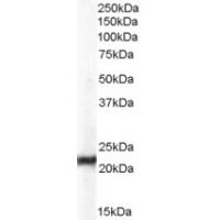 Western Blot (0.03μg/ml) staining of Hela lysate (35μg protein in RIPA buffer). Primary incubation was 1 hour. Detected by chemiluminescence.