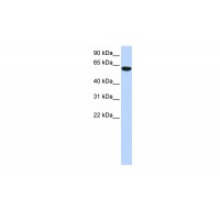 Antibody used in WB on Human 293T at 0.2-1 ug/ml.