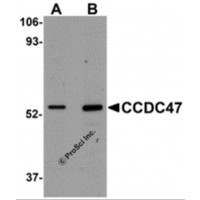 Western blot analysis of CCDC47 in mouse heart tissue lysate with CCDC47 antibody at (A) 1 and (B) 2 μg/mL.