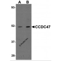 Western blot analysis of CCDC47 in mouse heart tissue lysate with CCDC47 antibody at (A) 1 and (B) 2 μg/mL.