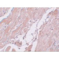 Immunohistochemistry of CCDC47 in mouse heart tissue with CCDC47 antibody at 5 μg/mL.