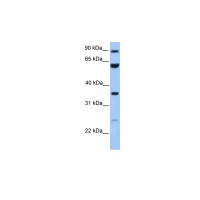 Antibody used in WB on Human Jurkat 0.2-1 ug/ml.