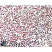 Immunohistochemistry (5μg/ml) staining of paraffin embedded Human Spleen. Steamed antigen retrieval with citrate buffer pH 6, AP-staining.