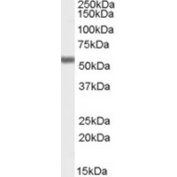 Western blot analysis of FOXC1 in human bone marrow lysate (RIPA buffer, 35 μg total protein per lane) using FOXC1 Antibody at 0.5 μg/mL.