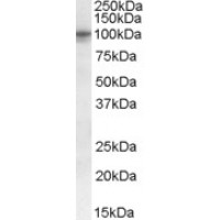 Western blot analysis of GPR71 in human pancreas lysate (35 μg protein in RIPA buffer) using GPR71 Antibody at 0.3 μg/mL.
