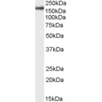 Western blot analysis of ITGAM in human cerebellum lysate (35 μg protein in RIPA buffer) using ITGAM Antibody at 0.3 μg/mL.