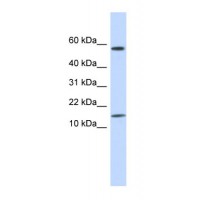 Western blot analysis of KRTAP11-1 in Placenta Lysate using KRTAP11-1 antibody at 1 μg/mL (10-20% gel).